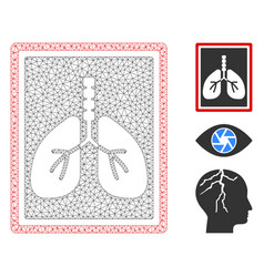 Lungs X-ray Photo Polygonal Frame Mesh