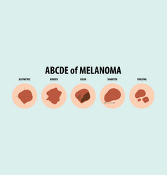 Guide To Five Types Of Skin Cancer