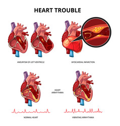 Heart Disease Infographics