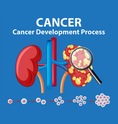 Cancer Development Process On Human Kidney