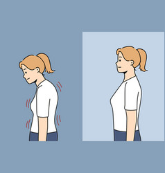 Stooped Woman Before And After Correcting Posture