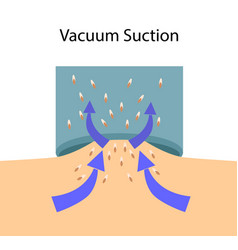 Scheme Vacuum Suction Process