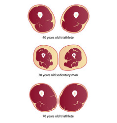 Comparison Of Muscle Mass