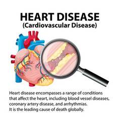 Medical Anatomy Infographic Sickness And Heart