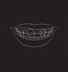 Smile With Teeth Braces In Linear Style Drawing