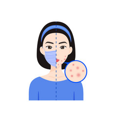 Asian Woman Wears Medical Mask Skin Problem Acne