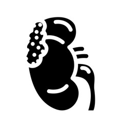 Kidney Cancer Glyph Icon