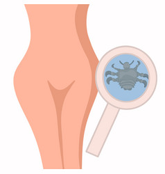 Female Pubic Lice