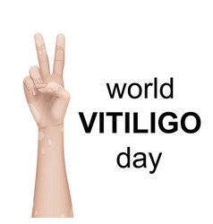 World Vitiligo Day