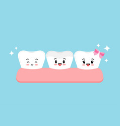 Cute Teeth With Ceramic Overlay In Gym Dental