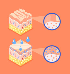 Skin Structure Cubes Composition