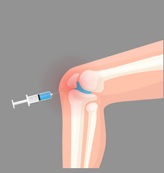 Knee Injection Inflammation Redness