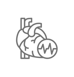 Obesity Heart Visceral Fat Heart Attack Line