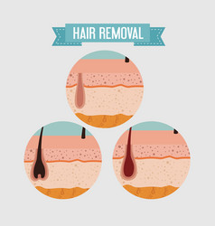 Layers Skin Structure With Hair Removal Icons