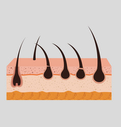 Layers Skin Structure With Hair Removal Icons