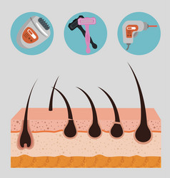 Layers Skin Structure With Hair Removal Icons