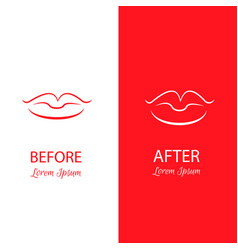 Lips Reshaping Before And After Surgery Abstract