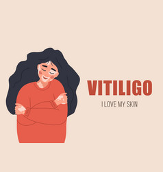 Woman With Vitiligo Self Care And Love