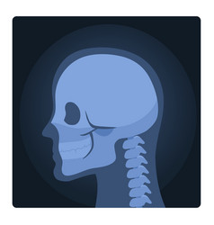 Medical Xray Scan Of Human Head