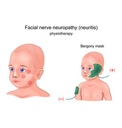 Physiotherapy Bergony Mask