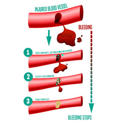 Blood Clot Formation