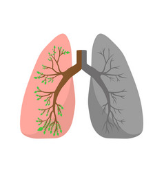 Normal Lung And Lung Cancer