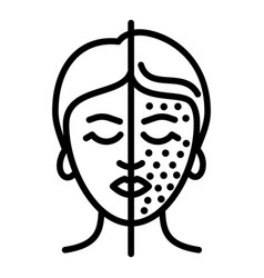 Woman Face Lifting Icon Outline Style