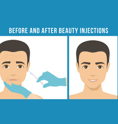 Cosmetic Procedures Botox