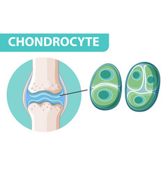 Informative Poster Chondrocyte