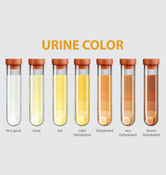 Urine color chart Royalty Free Vector Image - VectorStock