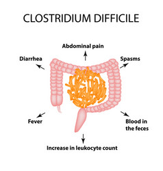 Clostridium Difficile Pathogenic Flora