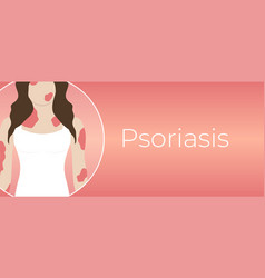 Psoriasis Illness Background With Woman With Red