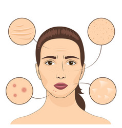 Woman Skin Problem Female Face With Skins