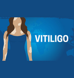 Blue Vitiligo Skin Illness Banner Background