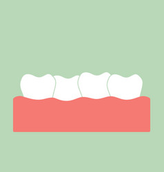 Crowding Teeth Malocclusion