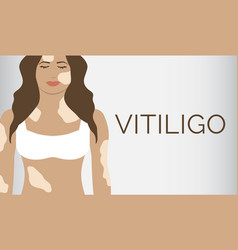 Vitiligo Skin Illness Banner Background