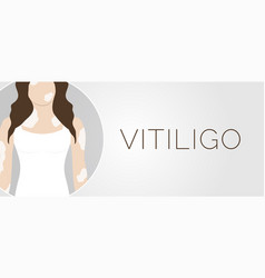 Vitiligo Skin Condition Banner Background