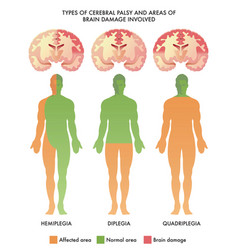 Cerebral Palsy Brain Damage