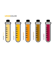 Medical Test Tube Urine Color Set