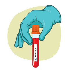 Hand Holding A Vial Blood To Zika Virus