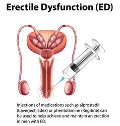 Erectile Dysfunction Ed Infographic