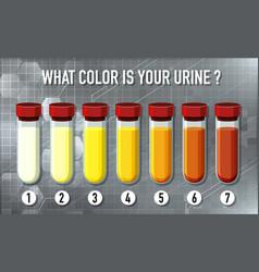 Urine Color Chart