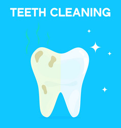 Teeth Cleaning Whitening Or Bleaching