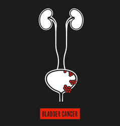 Bladder Cancer Icon