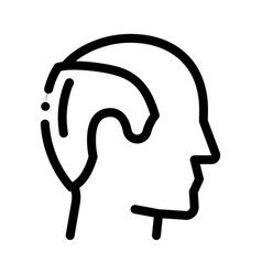 Man Hair Loss Icon Outline