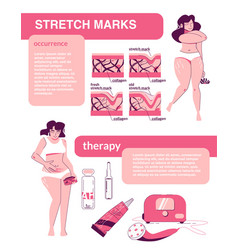 Female Stretch Marks Infographics