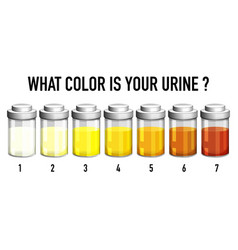 Urine Color Chart