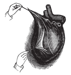 Heart In The Pericardium Vintage