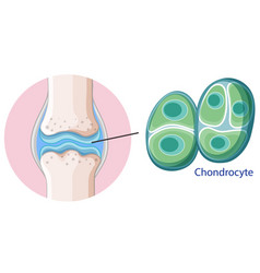 Informative Poster Chondrocyte