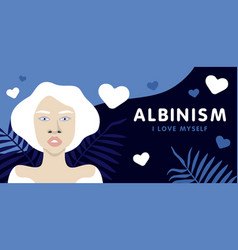 Banner About Albinism With Young Beautiful